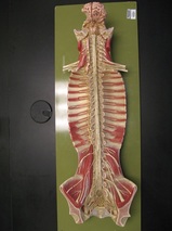 Spinal Cord Board (Somso) Picture