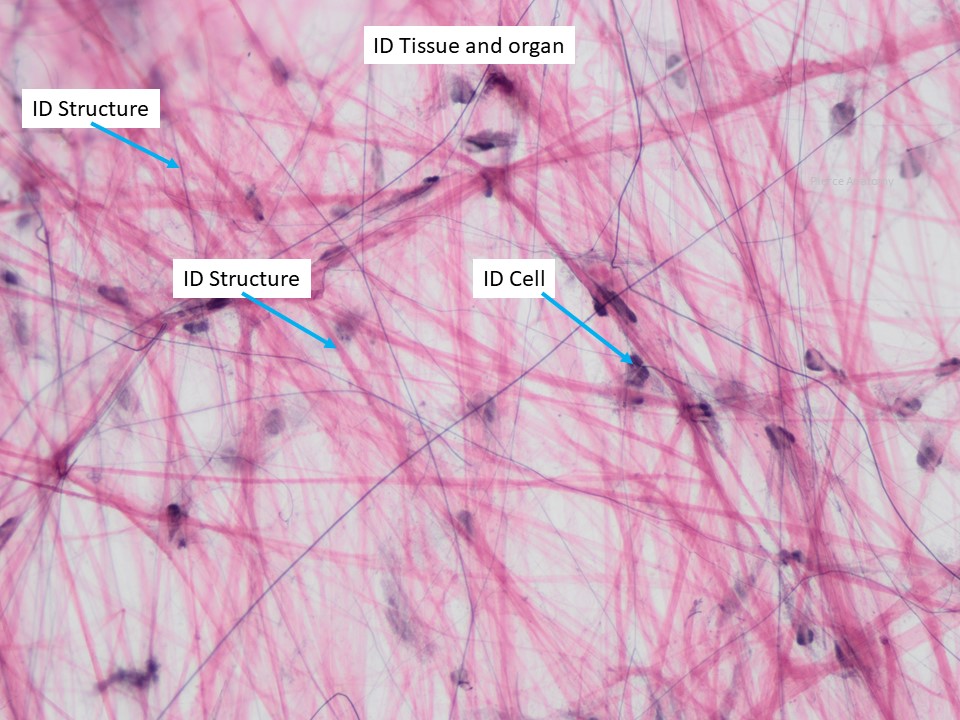 reticular connective tissue slides labeled